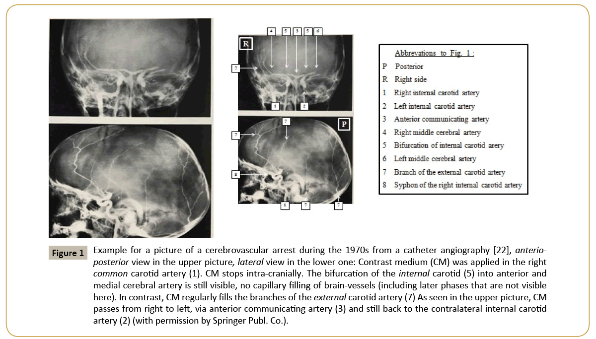 criticalcare-cerebrovascular