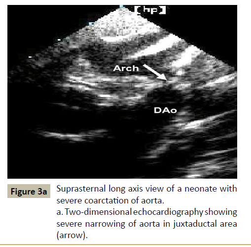 criticalcare-dimensional-echocardiography