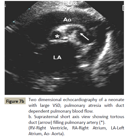 criticalcare-dimensional-echocardiography