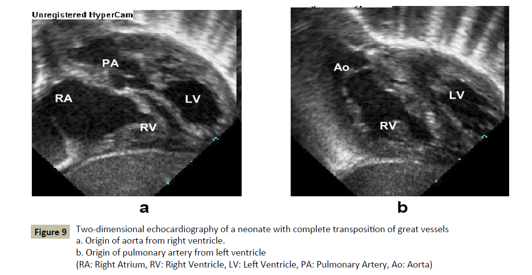 criticalcare-dimensional-echocardiography