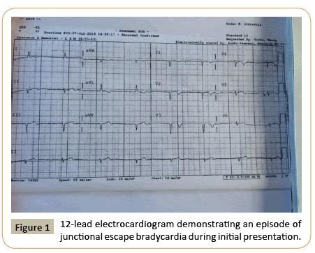 criticalcare-electrocardiogram-demonstrating