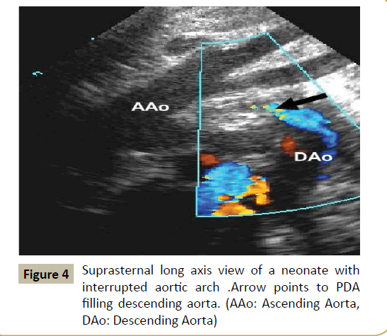 criticalcare-filling-descending