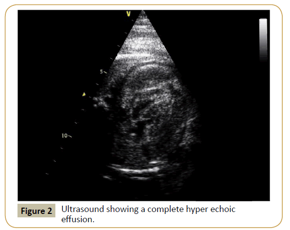 criticalcare-hyper-echoic