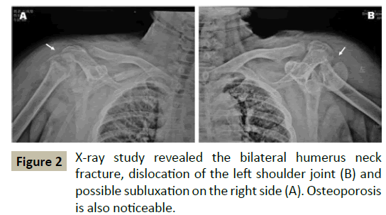 criticalcare-possible-subluxation