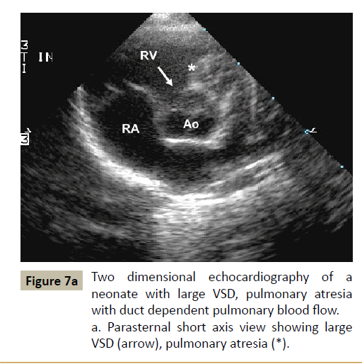 criticalcare-pulmonary-blood