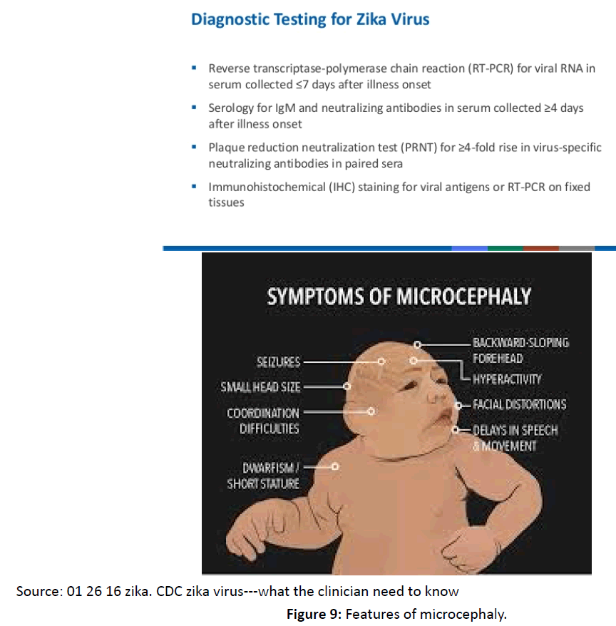 diversityhealthcare-Features-microcephaly
