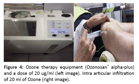 diversityhealthcare-Ozone-therapy