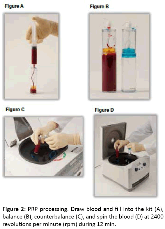 diversityhealthcare-PRP-processing