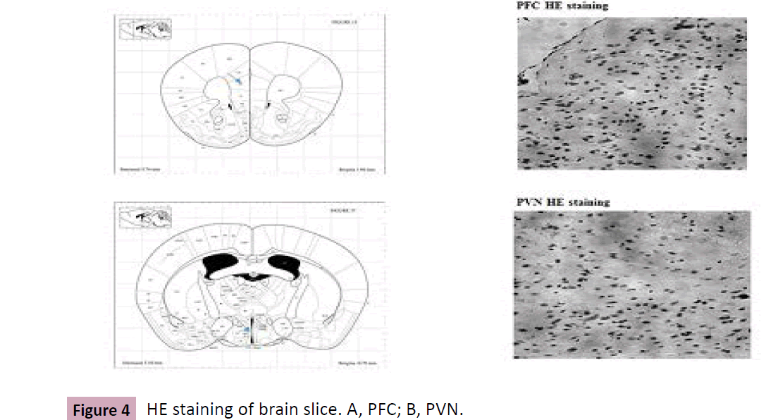 drug-abuse-brain-slice