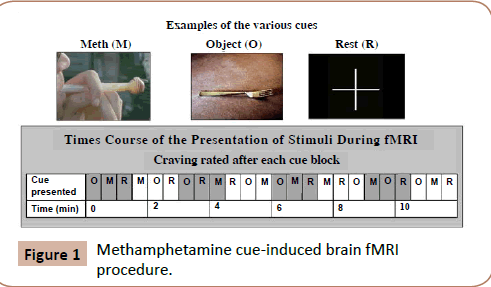 drugabuse-fMRI-procedure
