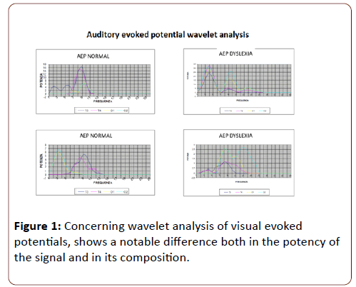 dual-diagnosis-Concerning-wavelet