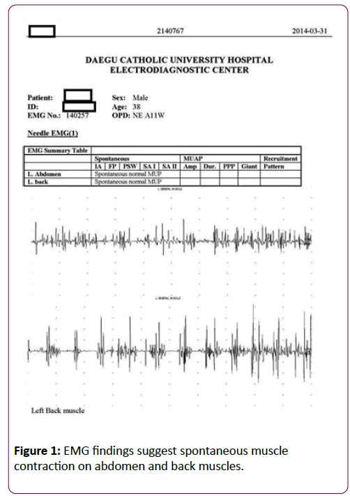 dual-diagnosis-EMG-findings