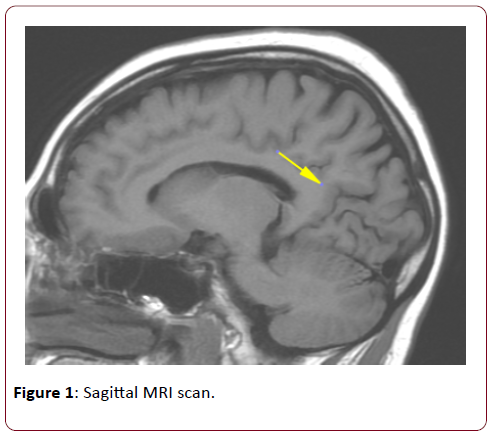 dual-diagnosis-Sagittal-MRI