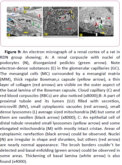 european-journal-experimental-biology-renal-corpuscle