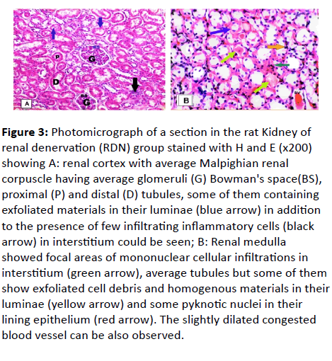 european-journal-experimental-biology-renal-denervation