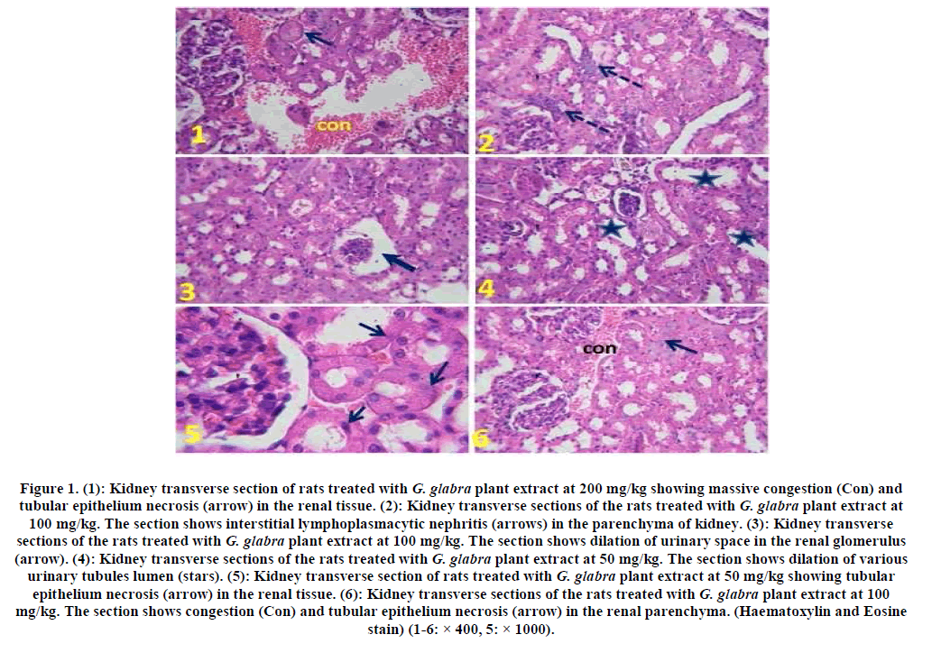 european-journal-of-experimental-Kidney-transverse