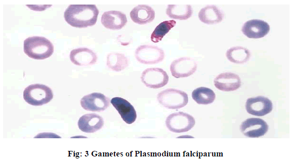 european-journal-of-experimental-Plasmodium-falciparum