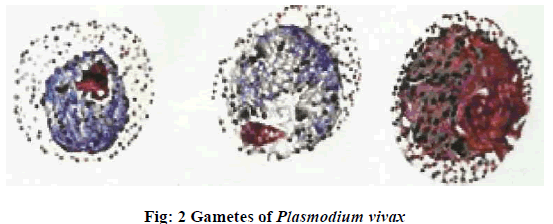 european-journal-of-experimental-Plasmodium-vivax