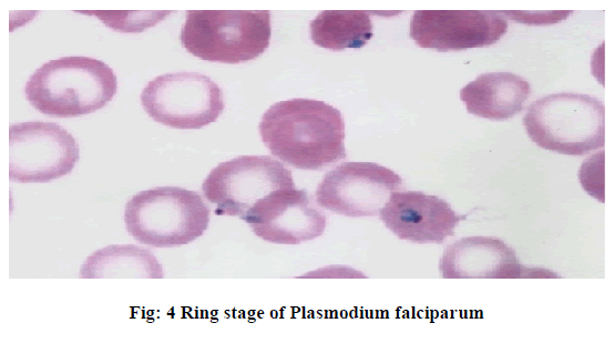 european-journal-of-experimental-Ring-stage