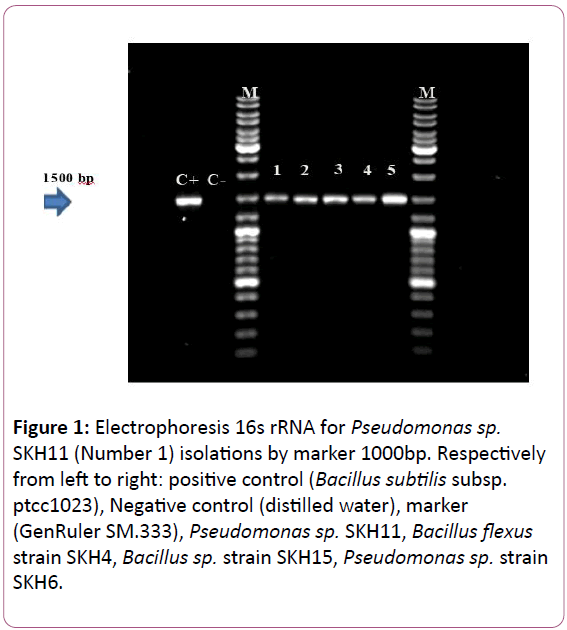 european-journal-of-experimental-biology-Electrophoresis