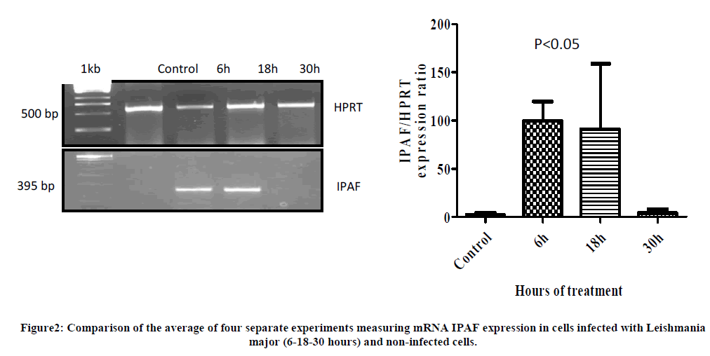 european-journal-of-experimental-cells-infected