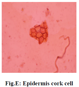 experimental-biology-Epidermis-cork