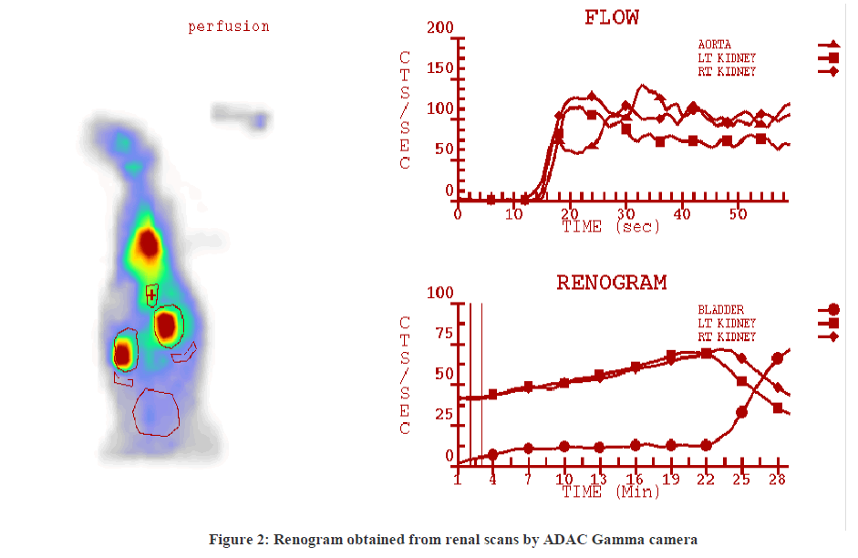 experimental-biology-Gamma-camera