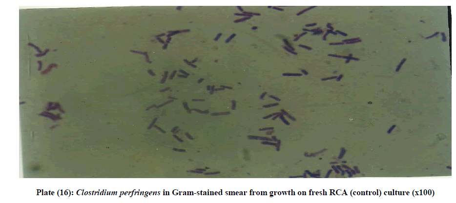 experimental-biology-Gram-stained-smear