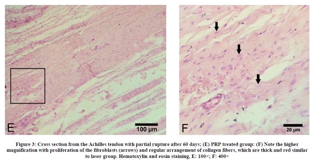 experimental-biology-PRP-treated-group