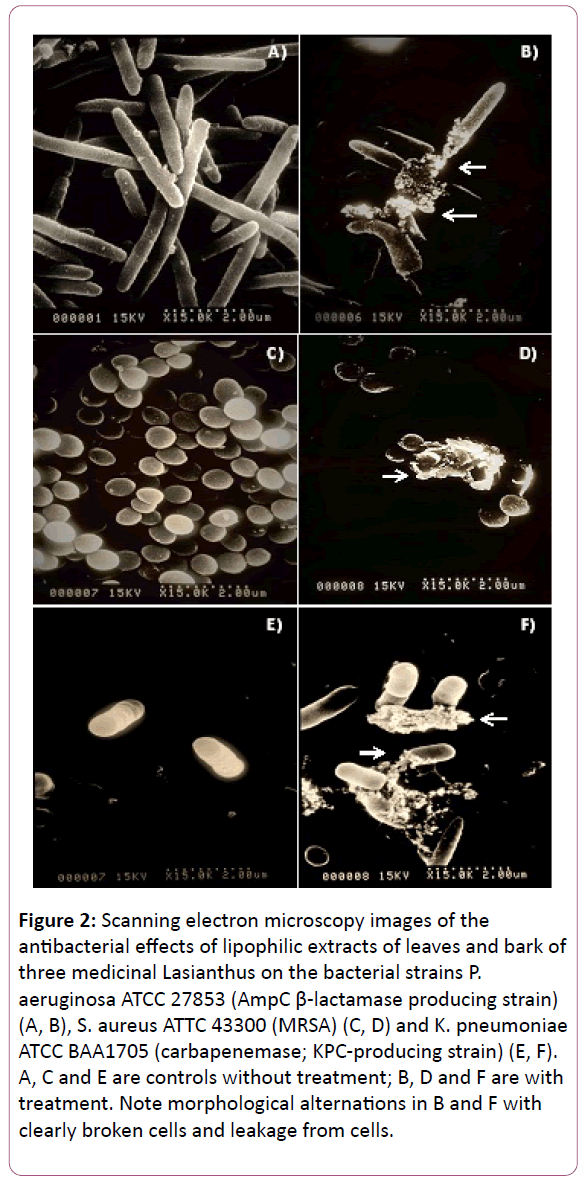 experimental-biology-Scanning-electron