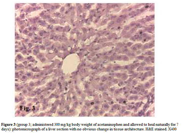 experimental-biology-acetaminophen-allowed