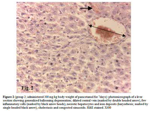 experimental-biology-ballooning-degeneration