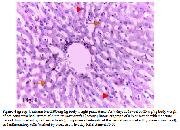 experimental-biology-body-weight-paracetamol