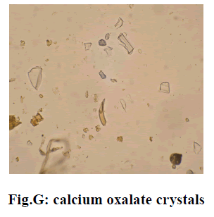 experimental-biology-calcium-oxalate