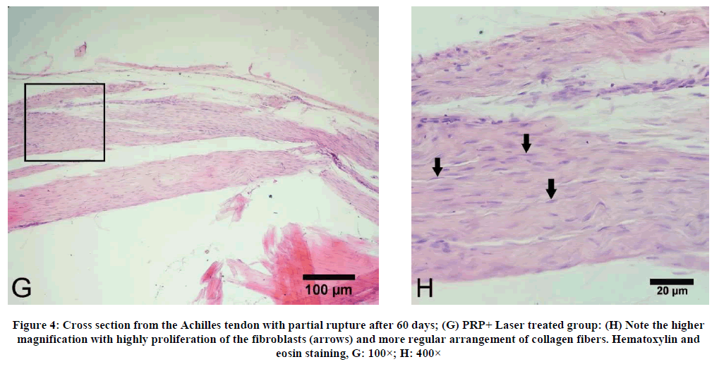 experimental-biology-highly-proliferation-fibroblasts