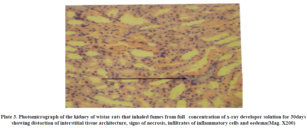 experimental-biology-infiltrates-inflammatory