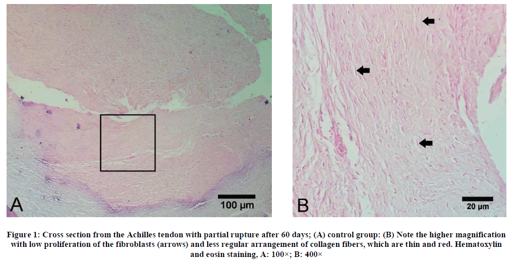 experimental-biology-partial-rupture