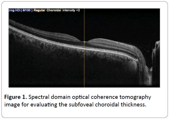 experimental-optical-coherence-tomography