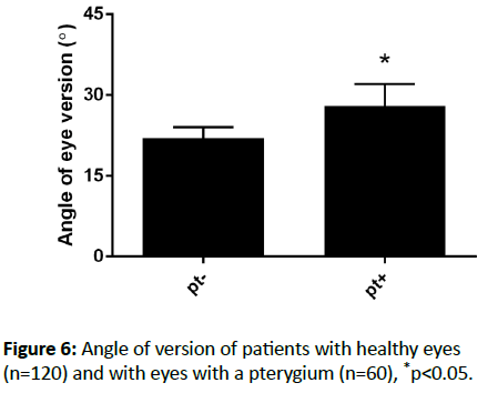 eye-cataract-surgery-Angle-version