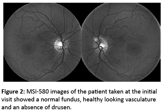 eye-cataract-surgery-MSI-580-images-patient