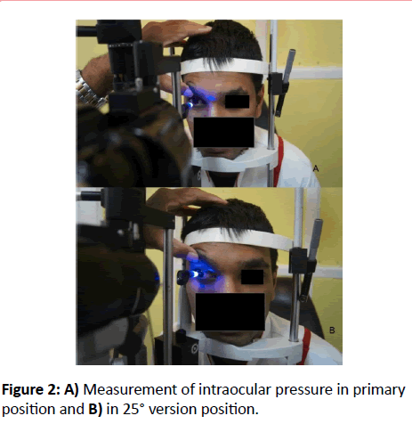 eye-cataract-surgery-Measurement-intraocular