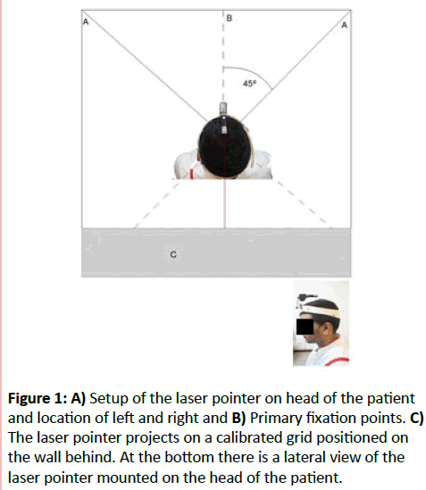 eye-cataract-surgery-Setup-laser