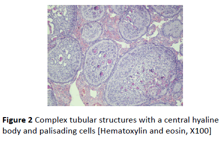 gynecology-obstetrics-Complex-tubular-structures