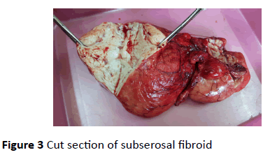 gynecology-obstetrics-Cut-section