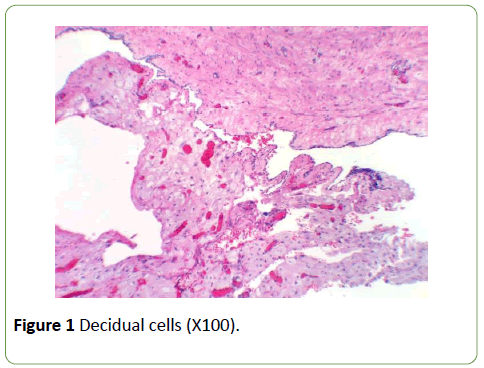 gynecology-obstetrics-Decidual-cells