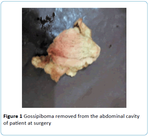 gynecology-obstetrics-RMI-asymmetry-torsion