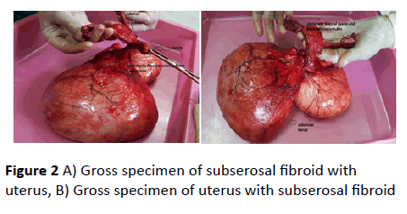 gynecology-obstetrics-Gross-specimen