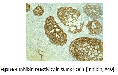 gynecology-obstetrics-Inhibin-reactivity