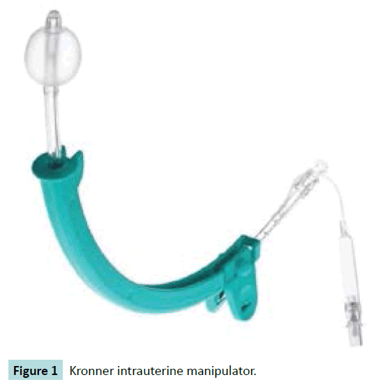 gynecology-obstetrics-Kronner-intrauterine