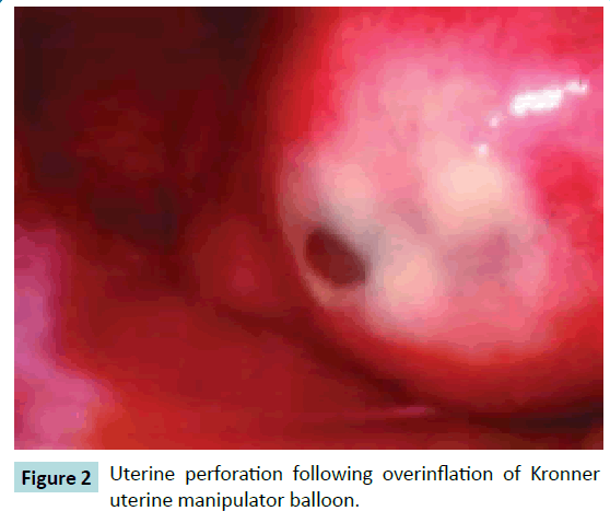 gynecology-obstetrics-Kronner-uterine